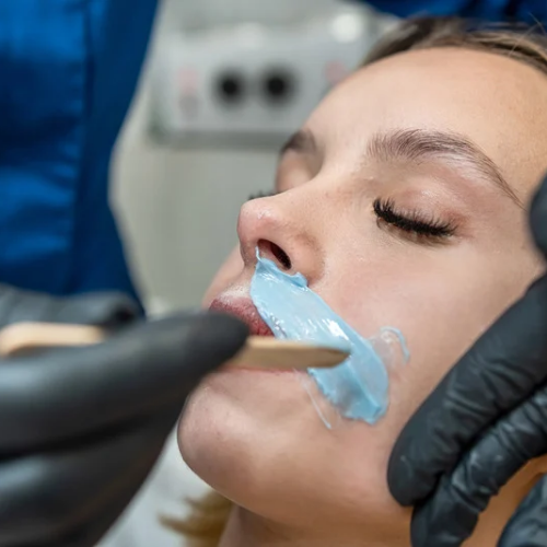 Upper Lips Waxing